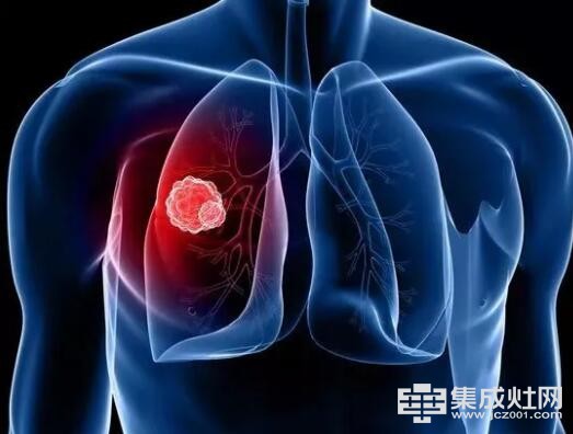 品冠集成灶：怪象 中国的女性肺癌患者80%从不吸烟她们为什么得癌